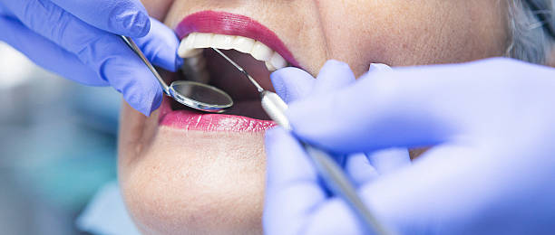 Best Broken or Cracked Tooth Emergency Dentist in Miles, TX